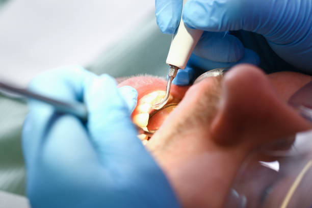 Best Emergency Dentist for Knocked-Out Tooth in Goodlettsville, TN
